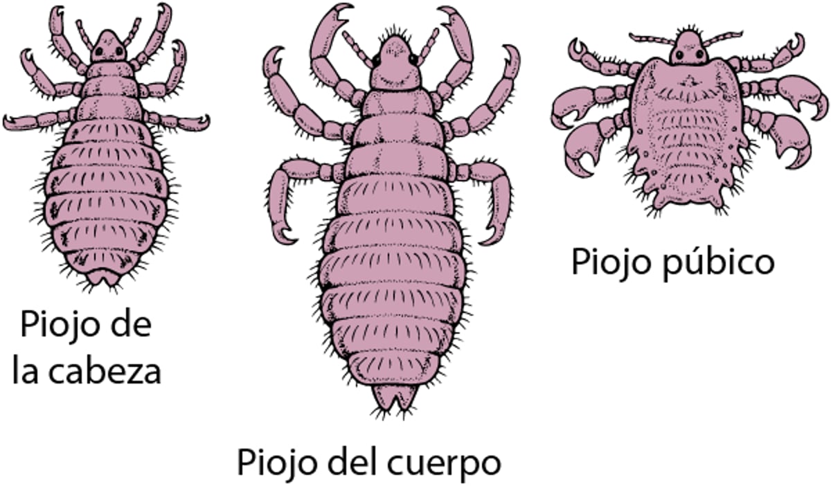 Aspecto de los piojos