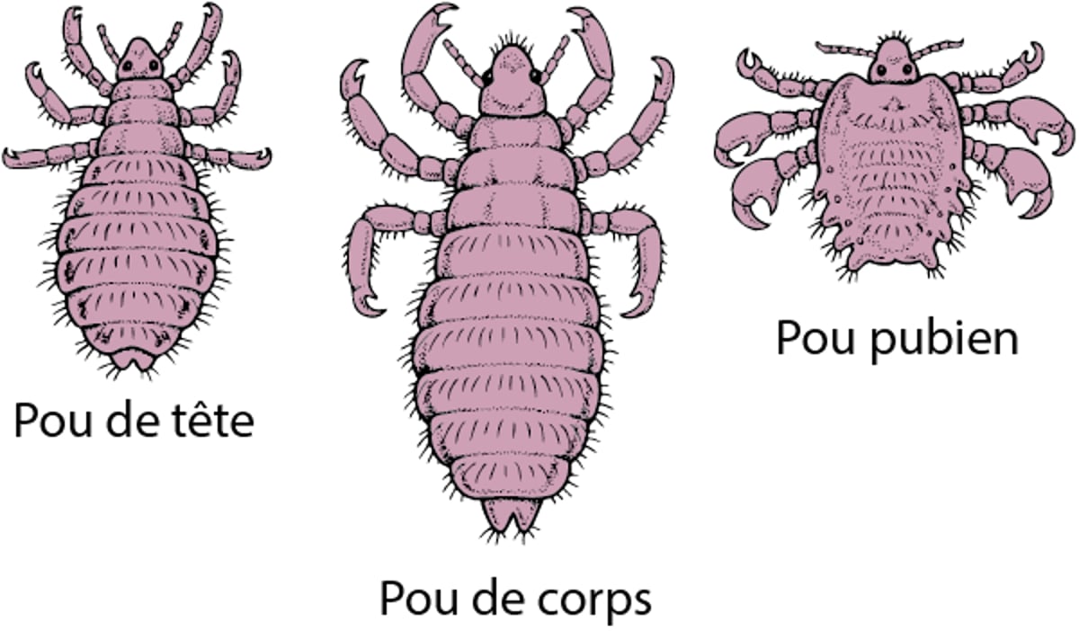 En savoir plus sur les poux
