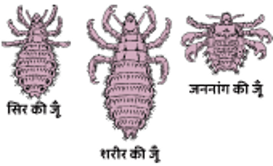 जूं का एक नज़दीकी चित्र