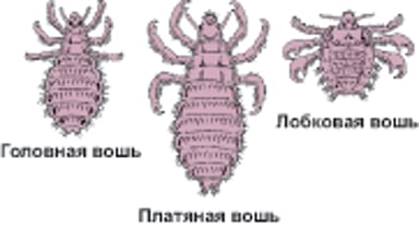 Изображение вшей крупным планом