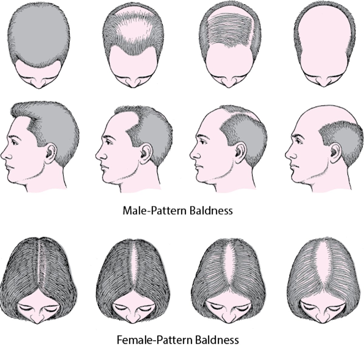 ImageLosing HairMSD Manual Consumer Version