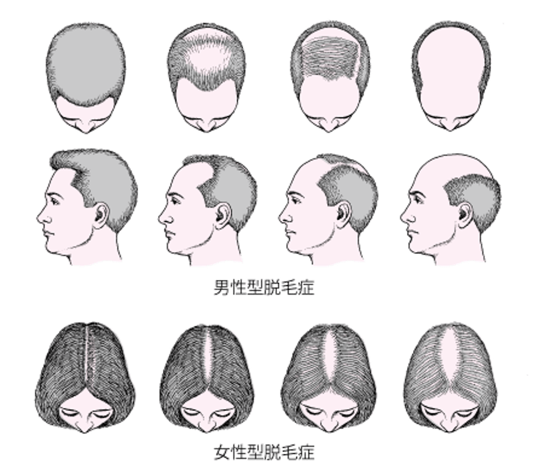 <ruby >頭髪<rt >とうはつ</rt></ruby>の<ruby >抜<rt >ぬ</rt></ruby>け<ruby >方<rt >かた</rt></ruby>