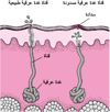 ما الذي يُسبِّبُ طفح الحرّ؟