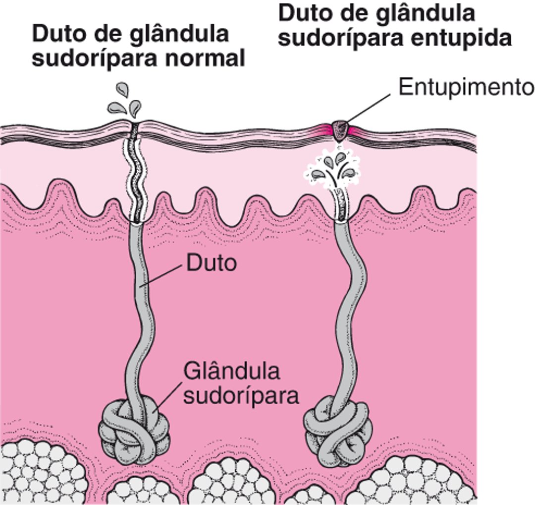 O que causa a brotoeja?