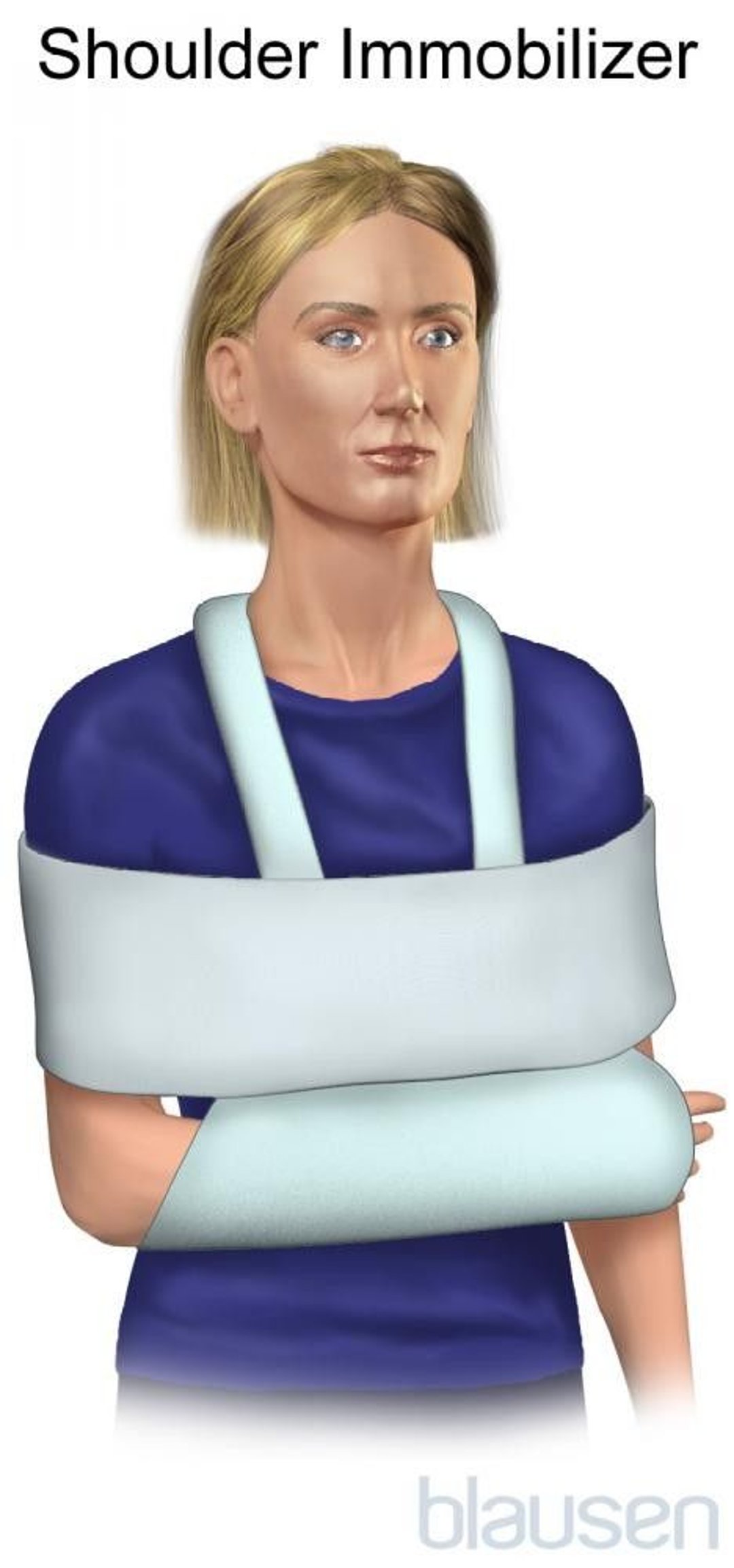 Shoulder Immobilizer