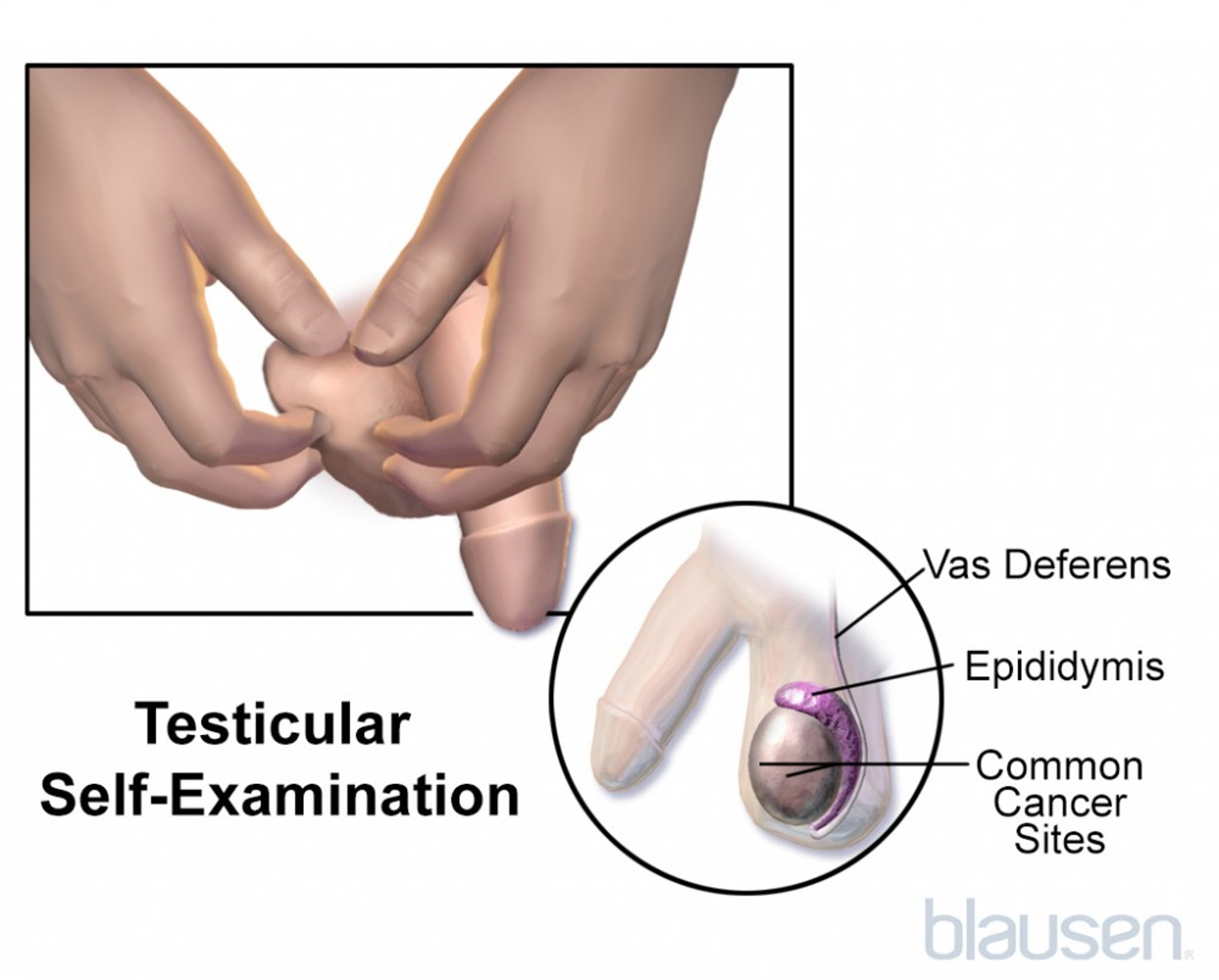Testicular Self-Examination