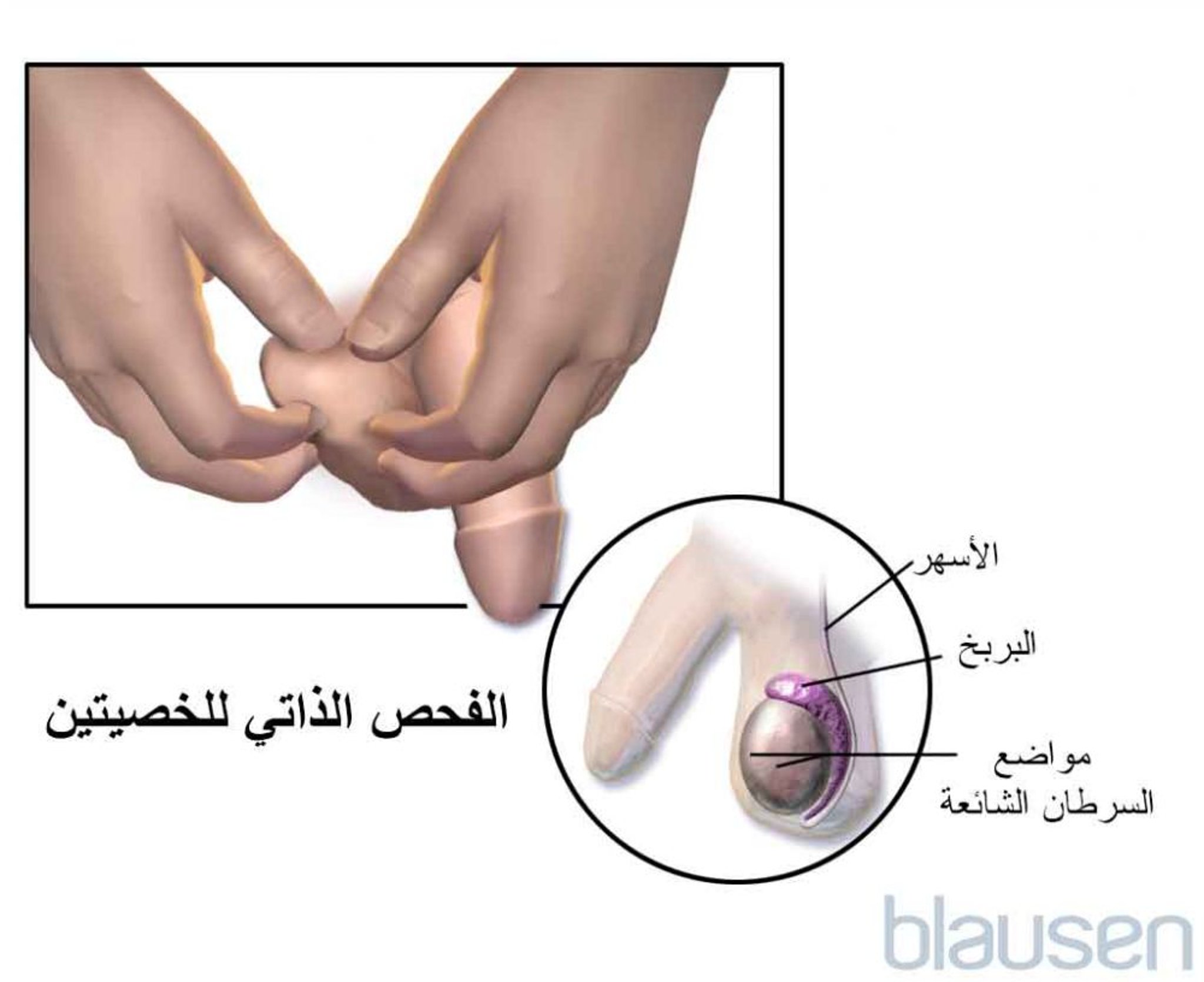 الفحص الذاتي للخصى