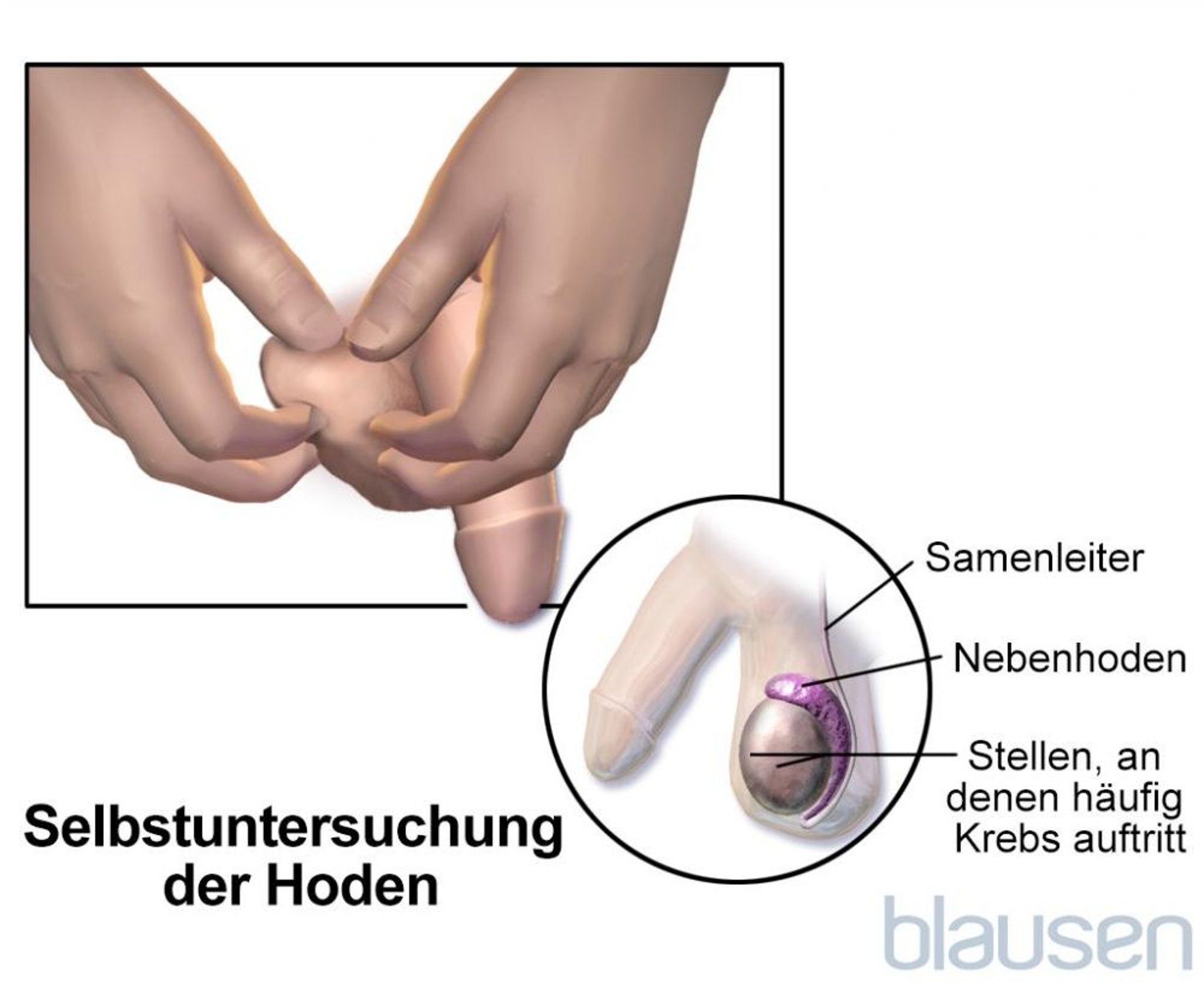 Selbstuntersuchung der Hoden
