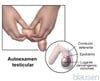 Autoexploración testicular