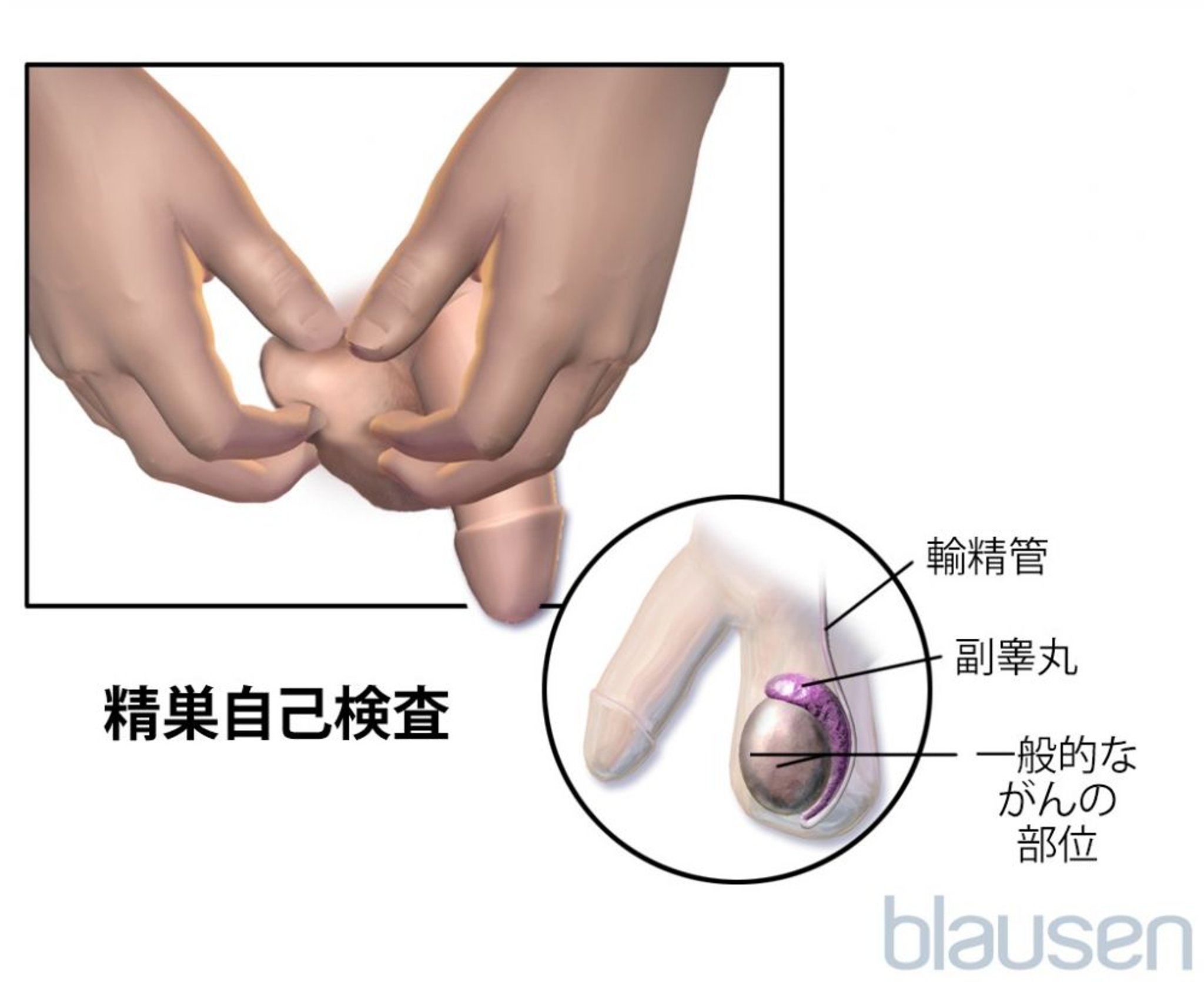 精巣自己検査