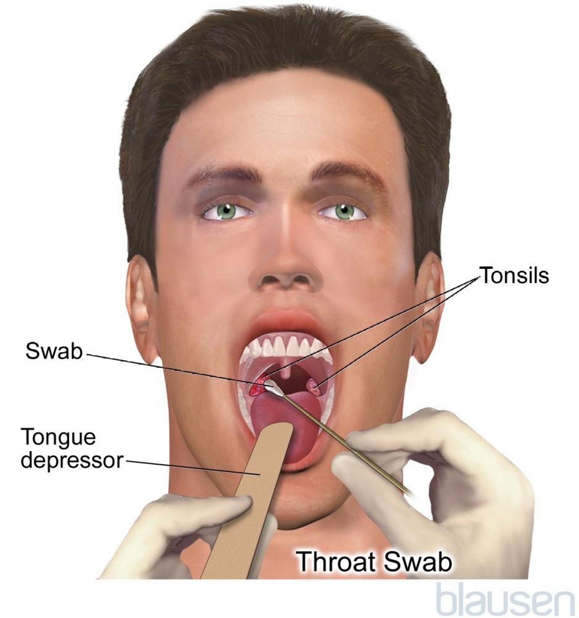 Throat Swab