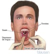 Swab de garganta