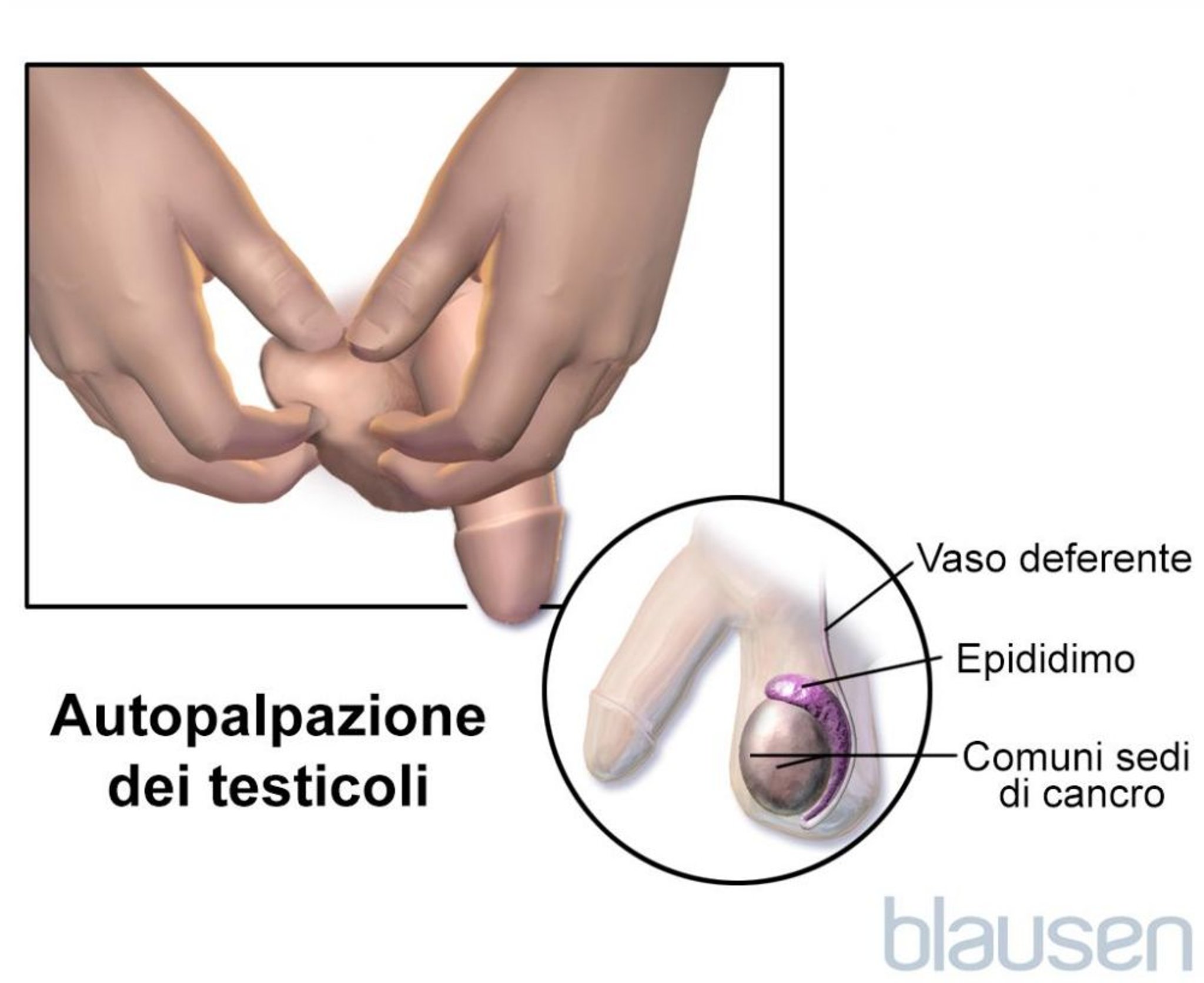 Autopalpazione dei testicoli