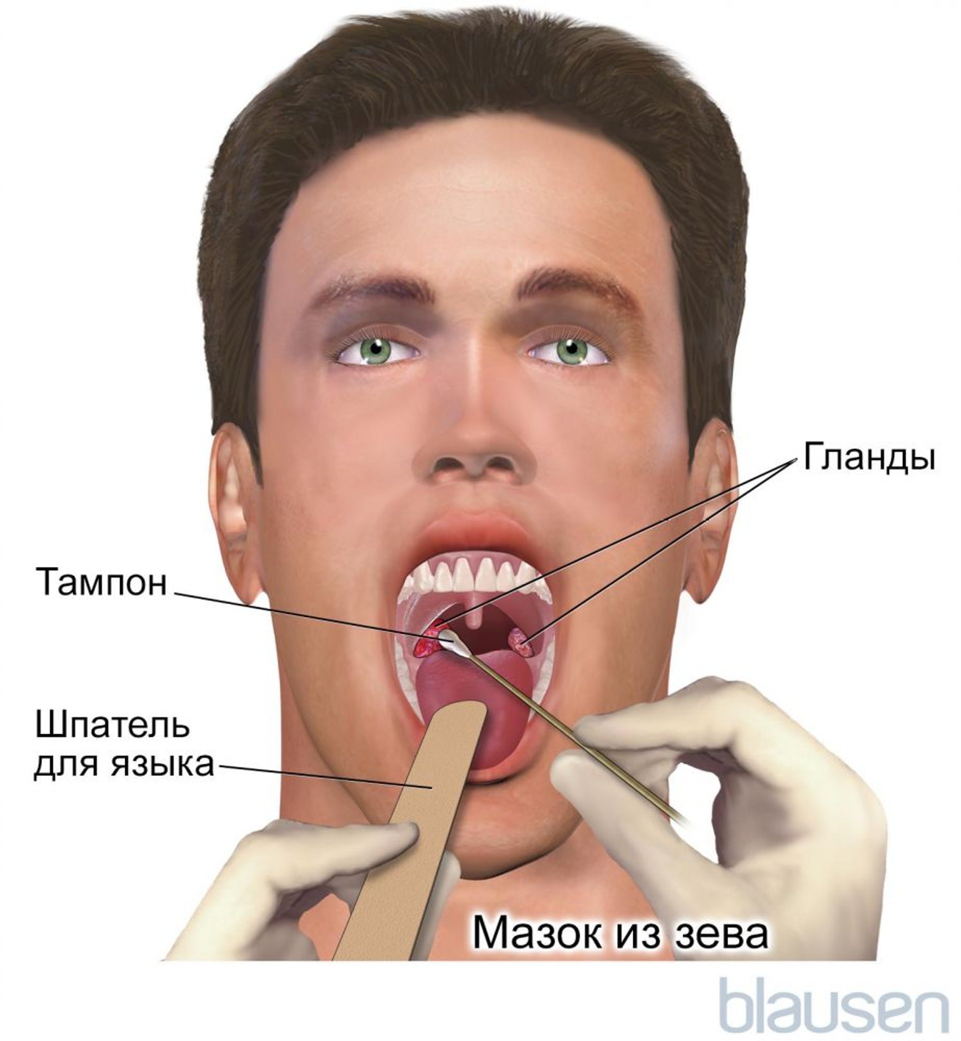 Мазок из зева