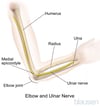 Nervio cubital