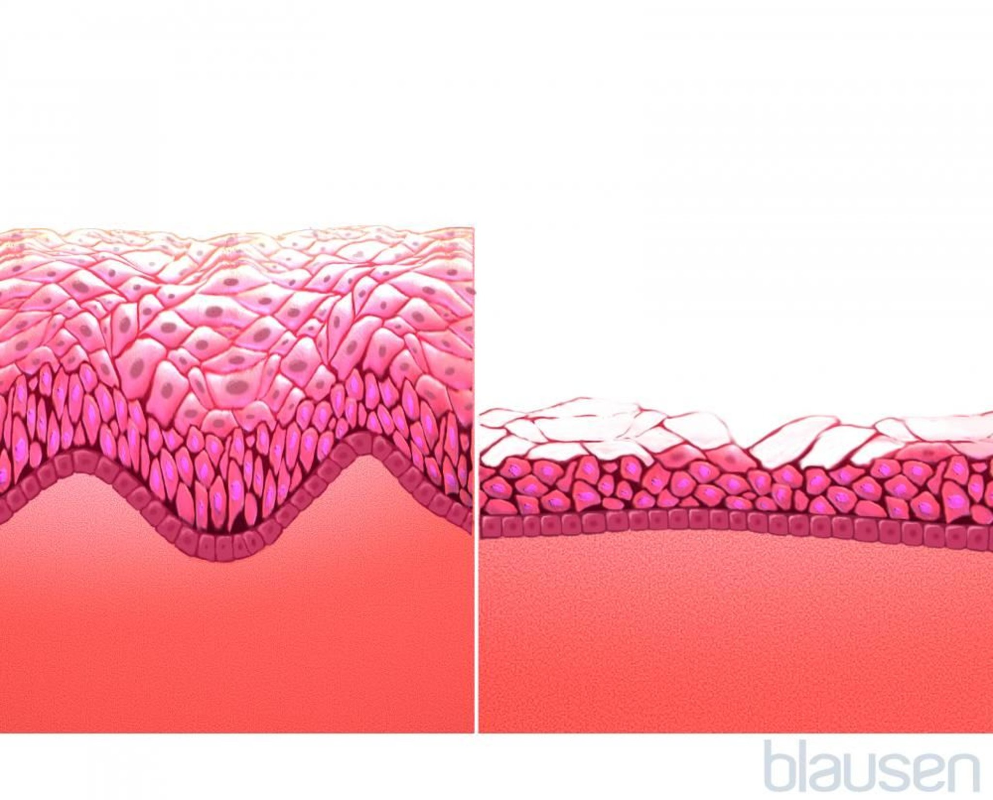 Mucosa vaginal (antes y después de la menopausia)