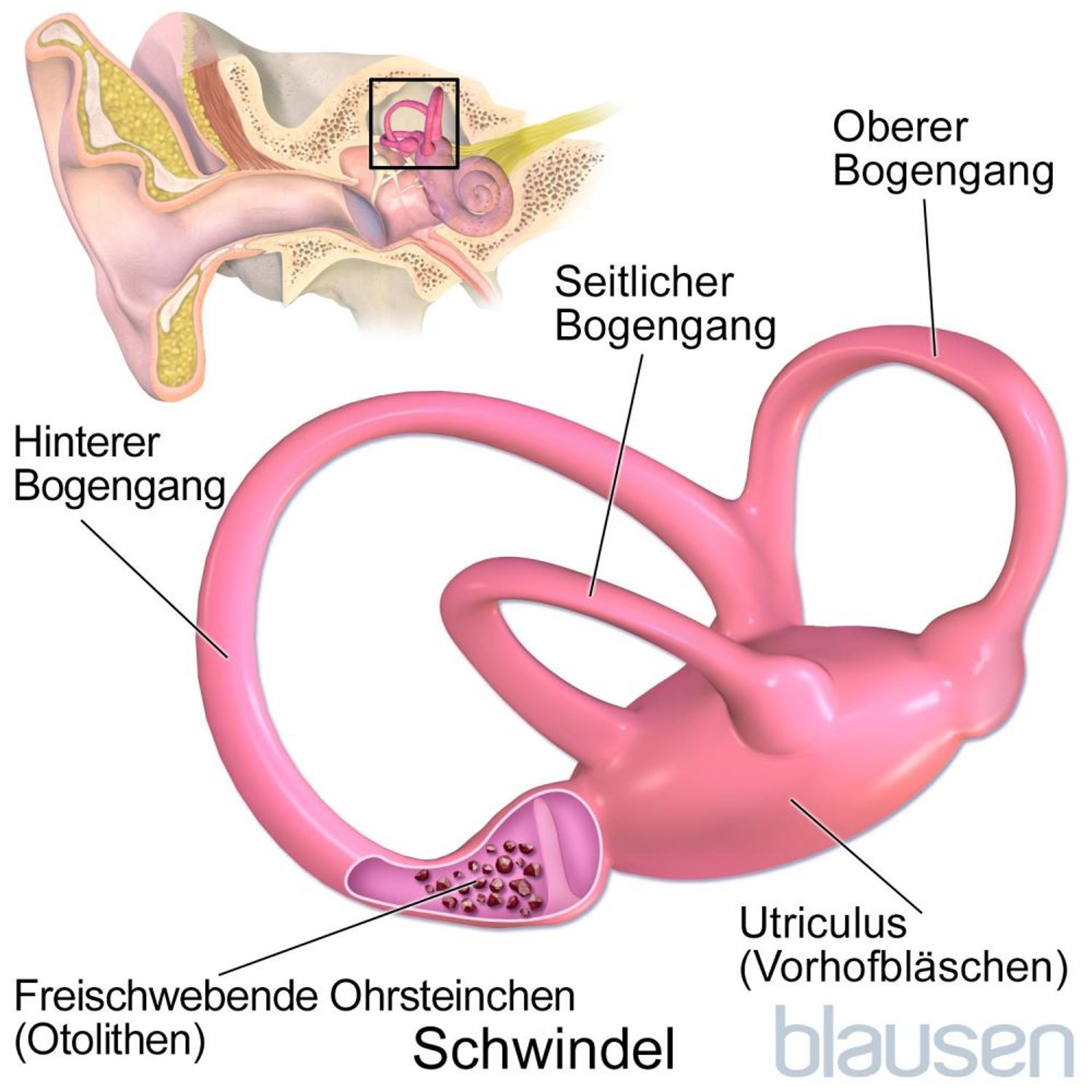 Schwindel