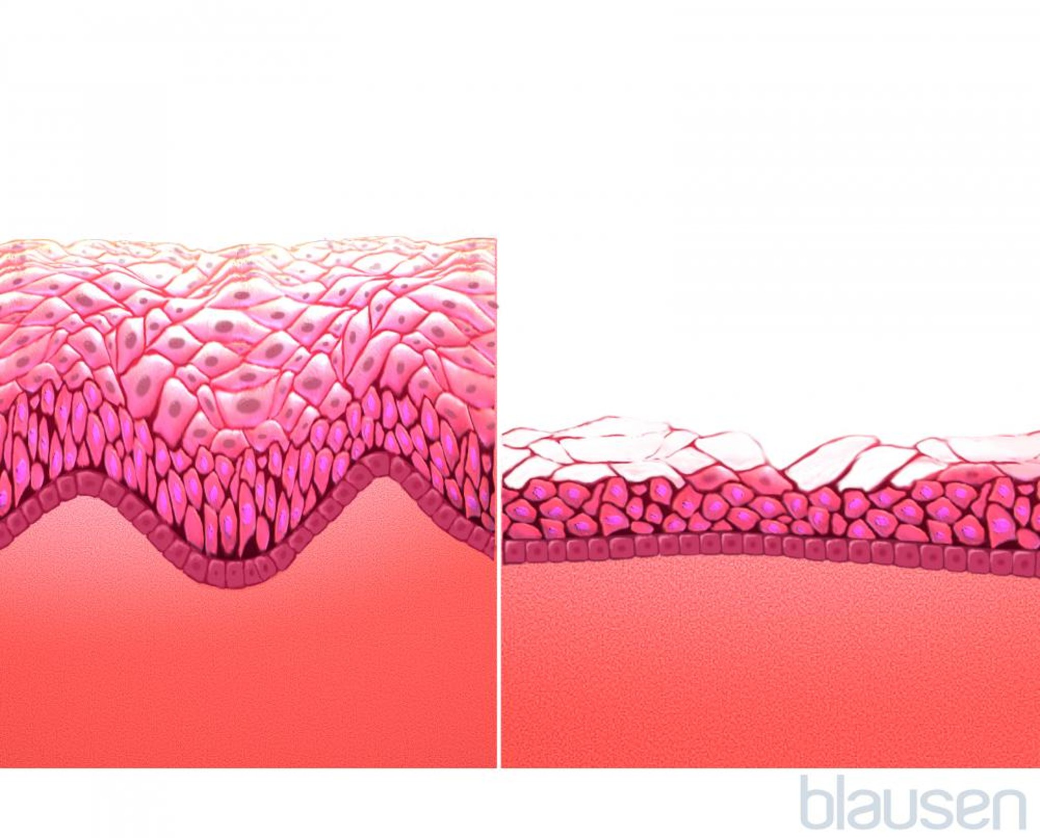 Mucosa vaginale (prima e dopo la menopausa)