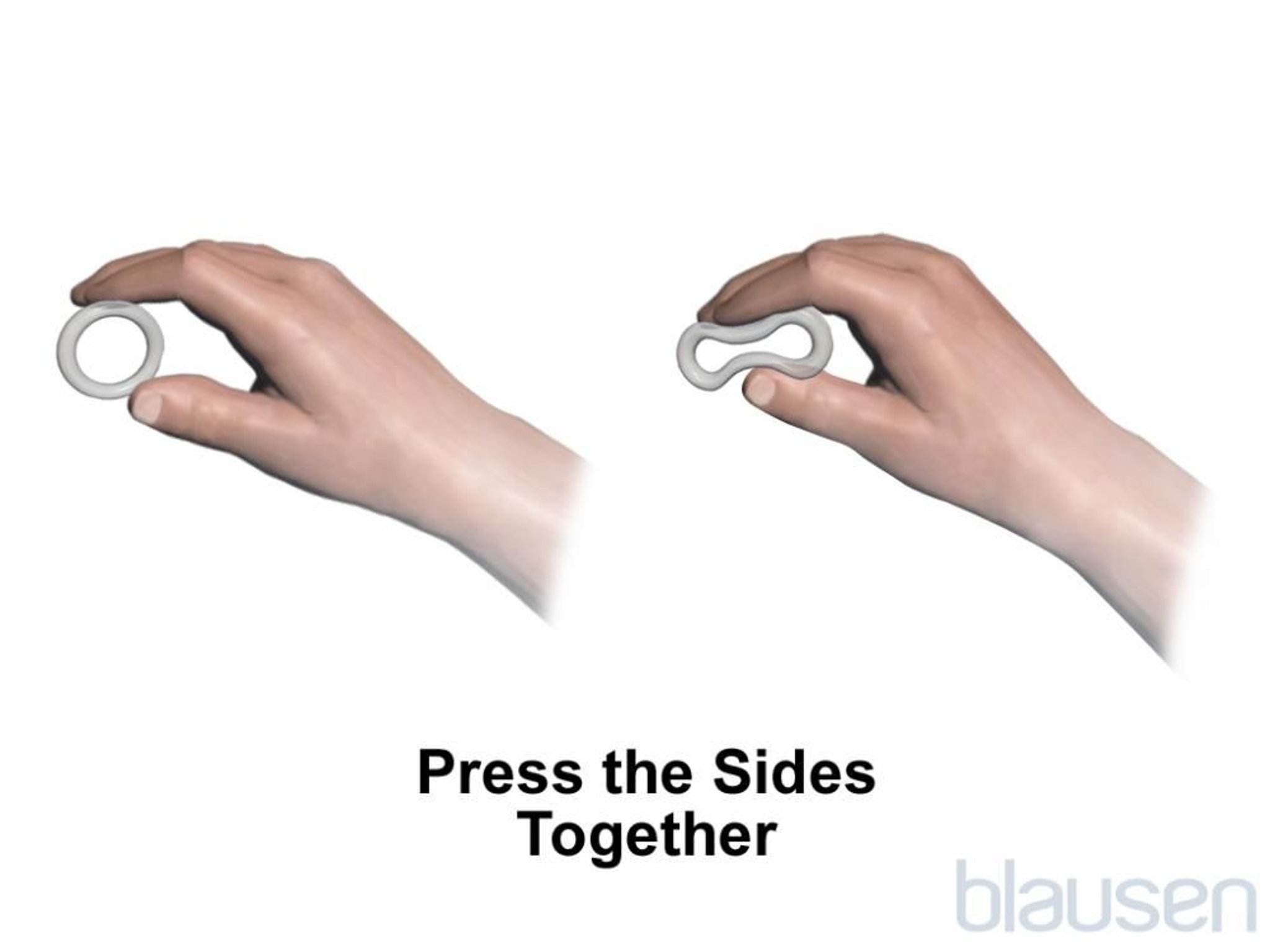 Inserimento dell’anello vaginale Passaggio 1