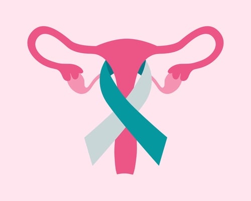 Ovarian Cancer, Fallopian Tube Cancer, and Peritoneal Cancer