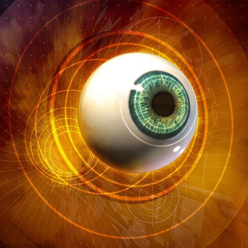 Eye Disorders Eye Disorders