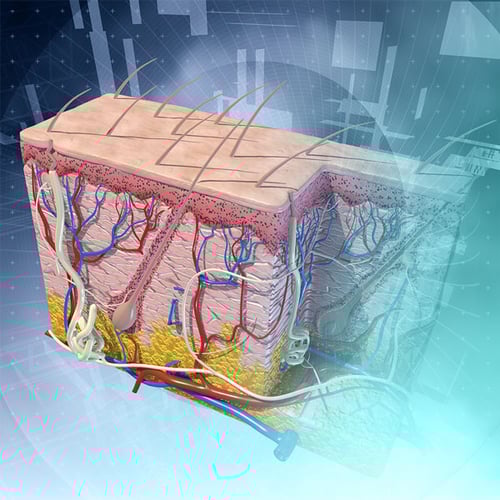 Dermatologic Disorders Dermatologic Disorders