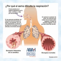 Abril es el mes de concientización sobre las enfermedades de transmisión sexual (ETS)