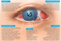 Como cuidar da saúde dos seus olhos