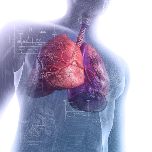 Troubles pulmonaires Troubles pulmonaires