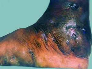 Pie de Madura