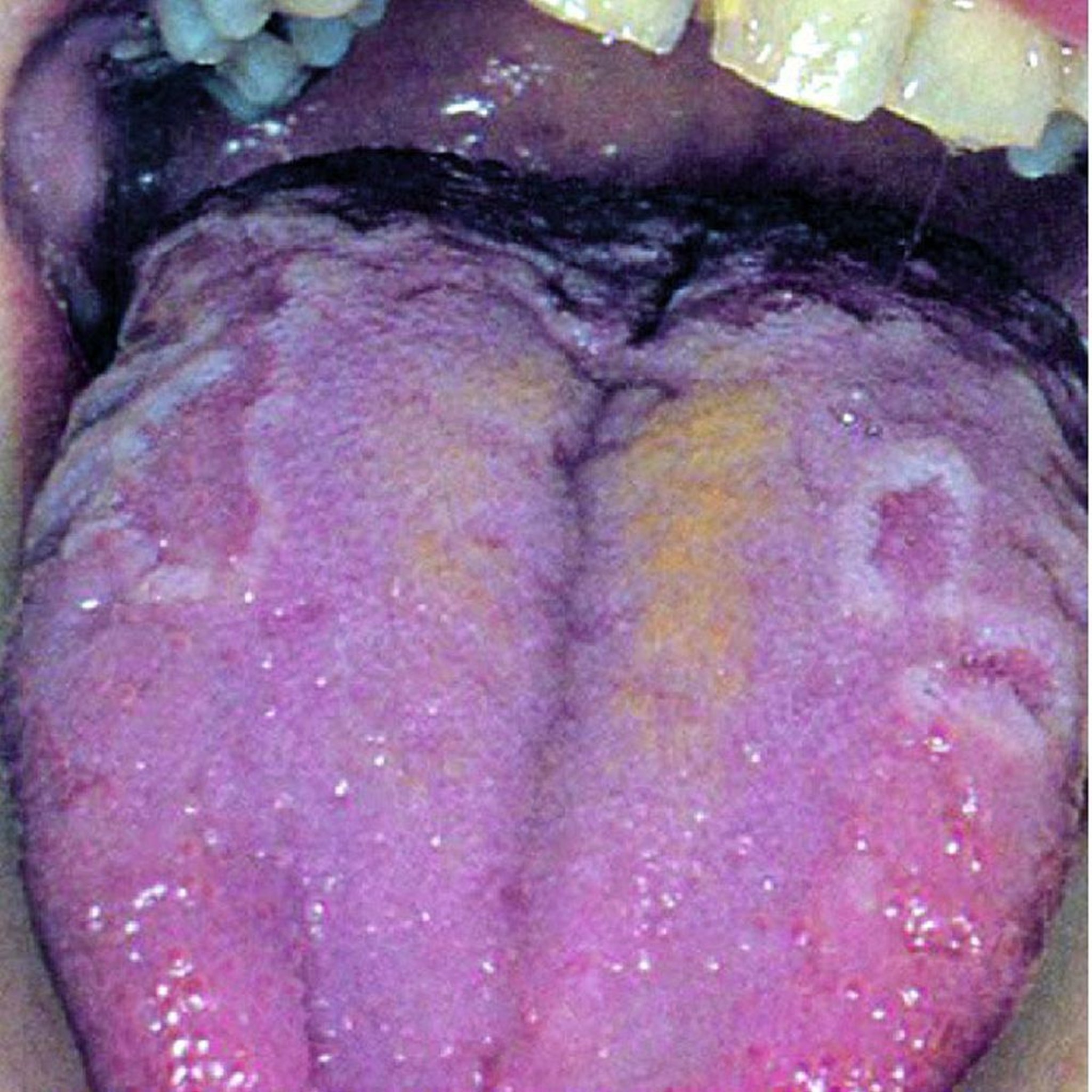 Lengua geográfica