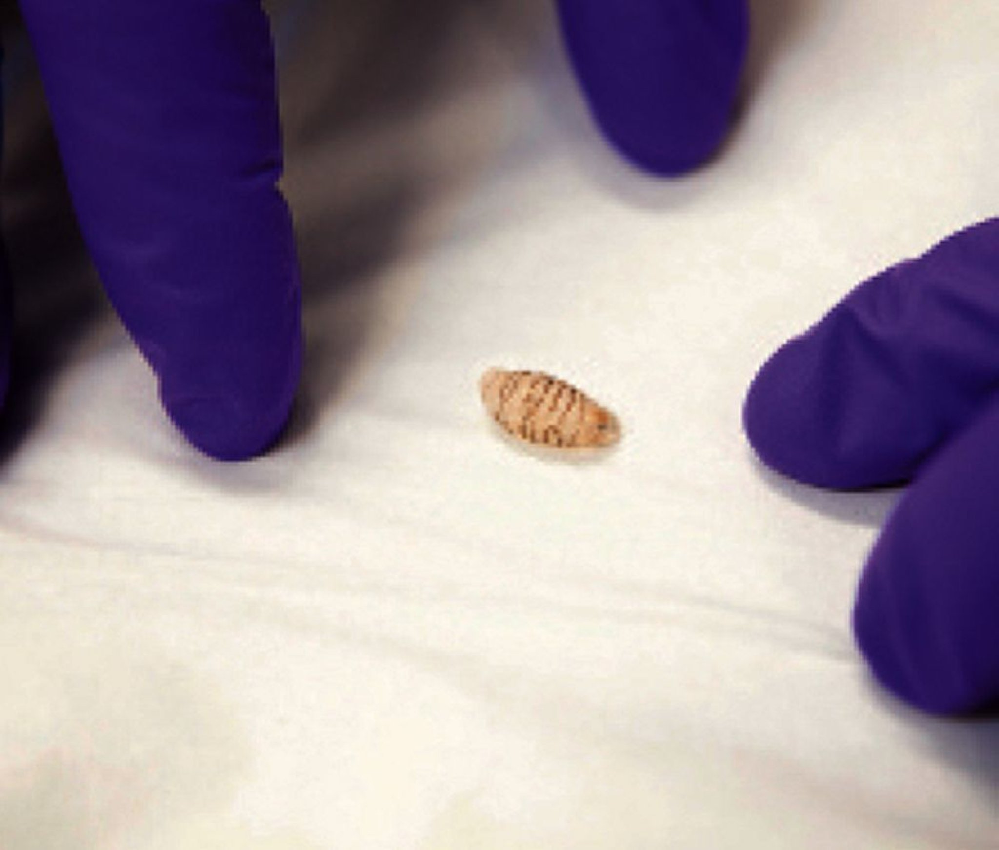 Bệnh nhiễm giòi Maggot