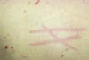 Dermatografismo