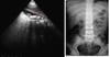 Imagerie abdominale (calculs biliaires)