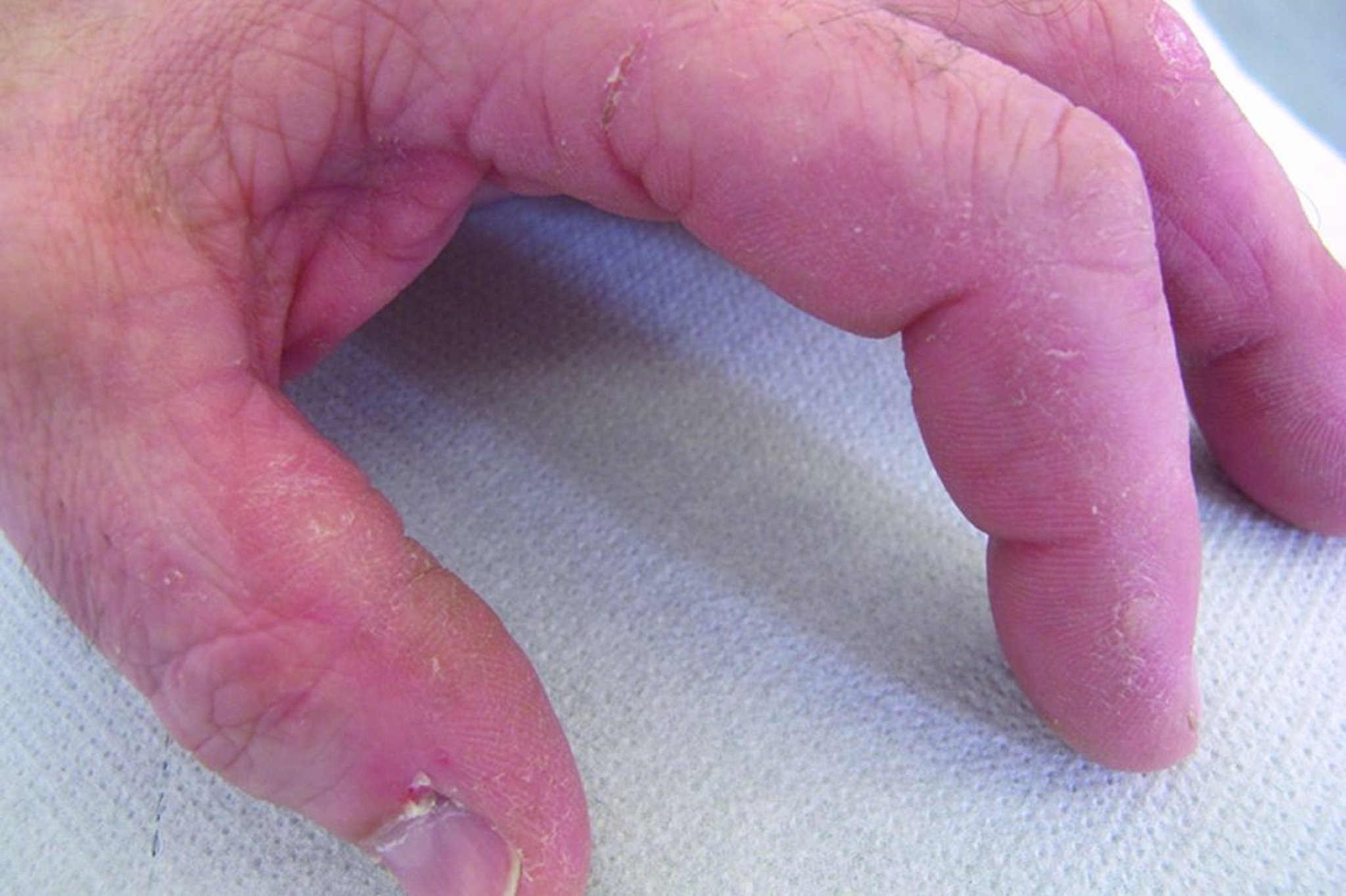 Mains du mécanicien (1)