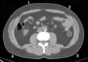 CT-Scan von Abdomen und Becken mit normaler Anatomie ohne Kontrastmittel (Folie 19)