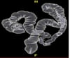 Colonografia por TC mostrando anatomia normal