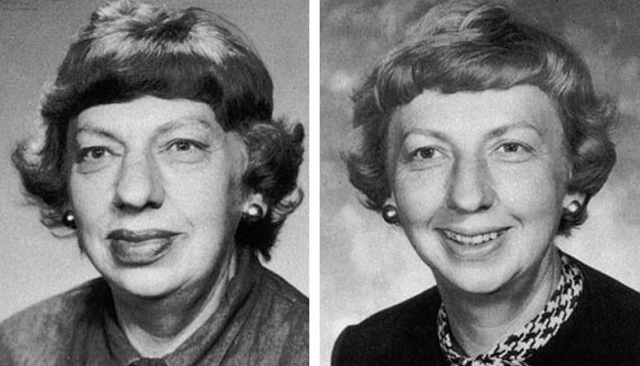 To cực chi (thay đổi ở mặt)