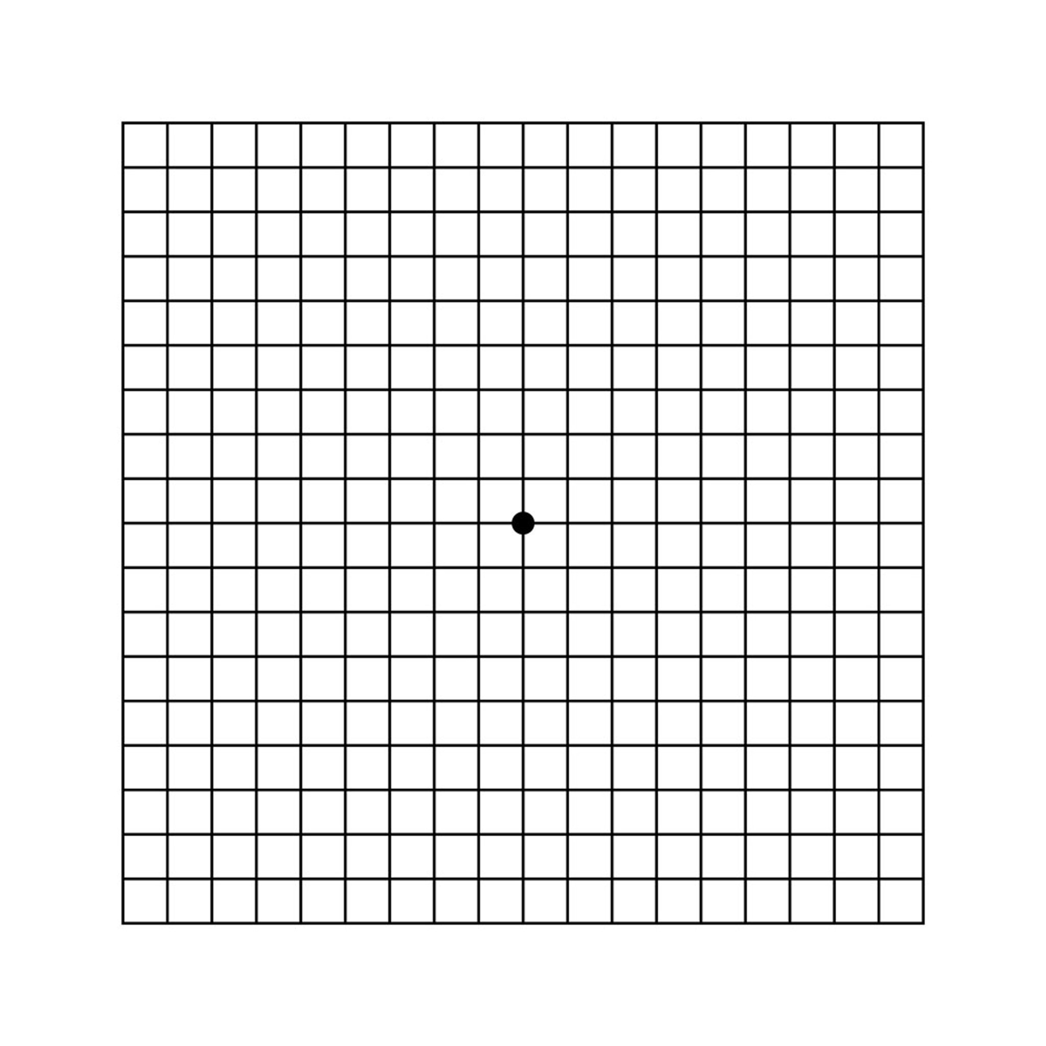 Amsler Grid