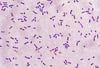 Tinción de gram (Streptococcus pneumoniae)