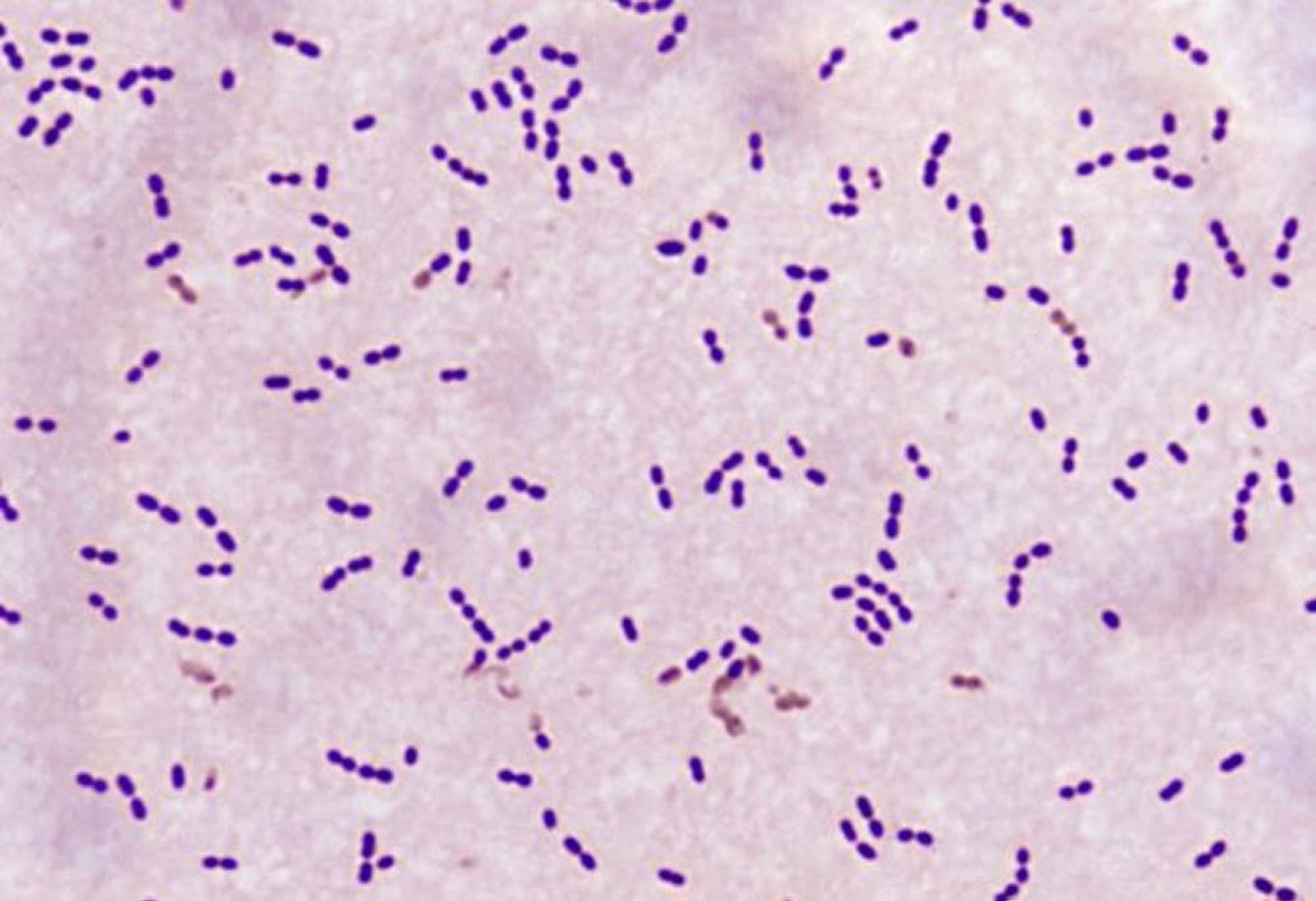 Coloration de Gram (<i >Streptococcus pneumoniae</i>)