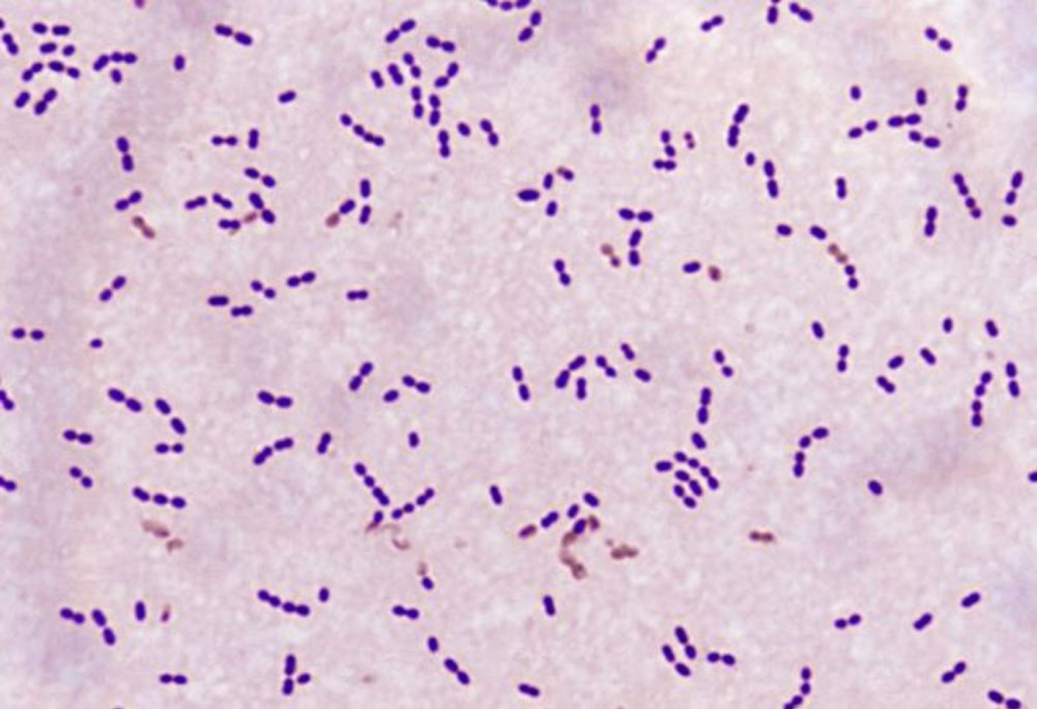 Coloração de Gram (<i >Streptococcus pneumoniae</i>)