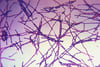 炭疽菌（Bacillus anthracis）
