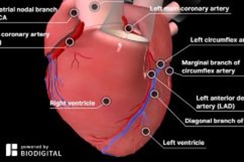 essay about coronary heart disease