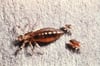 Körperlaus (Pediculus humanus var. corporis)