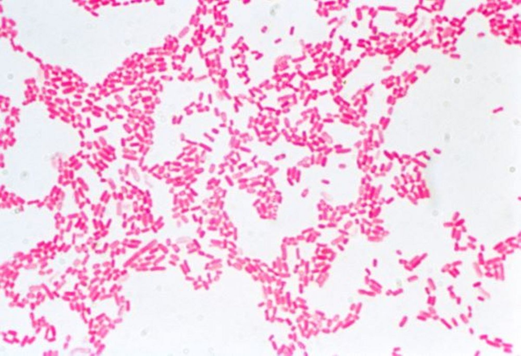 Gram-Färbung (<i >Escherichia coli</i>)