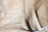 Jugular Venous Distention