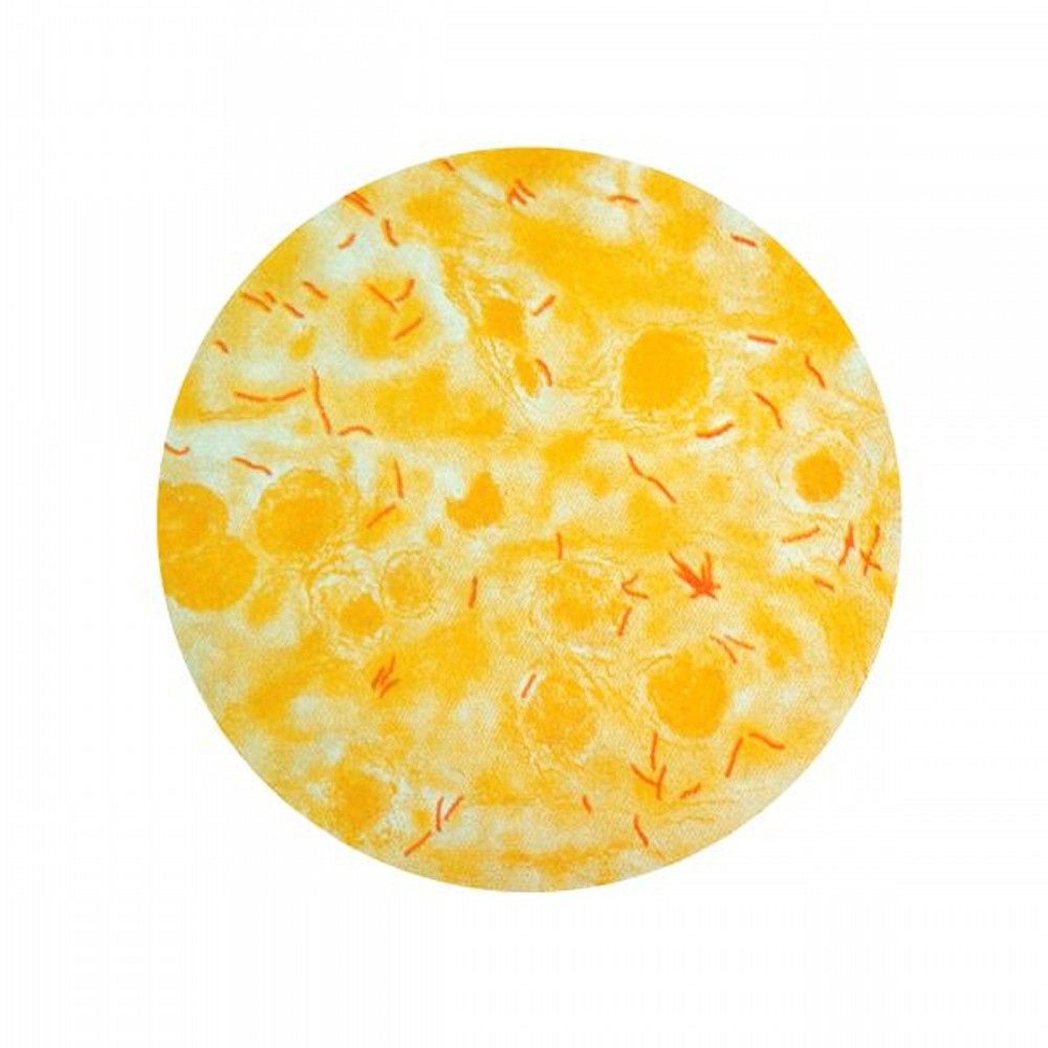 Acid-Fast Stain (<i >Mycobacterium tuberculosis</i>)