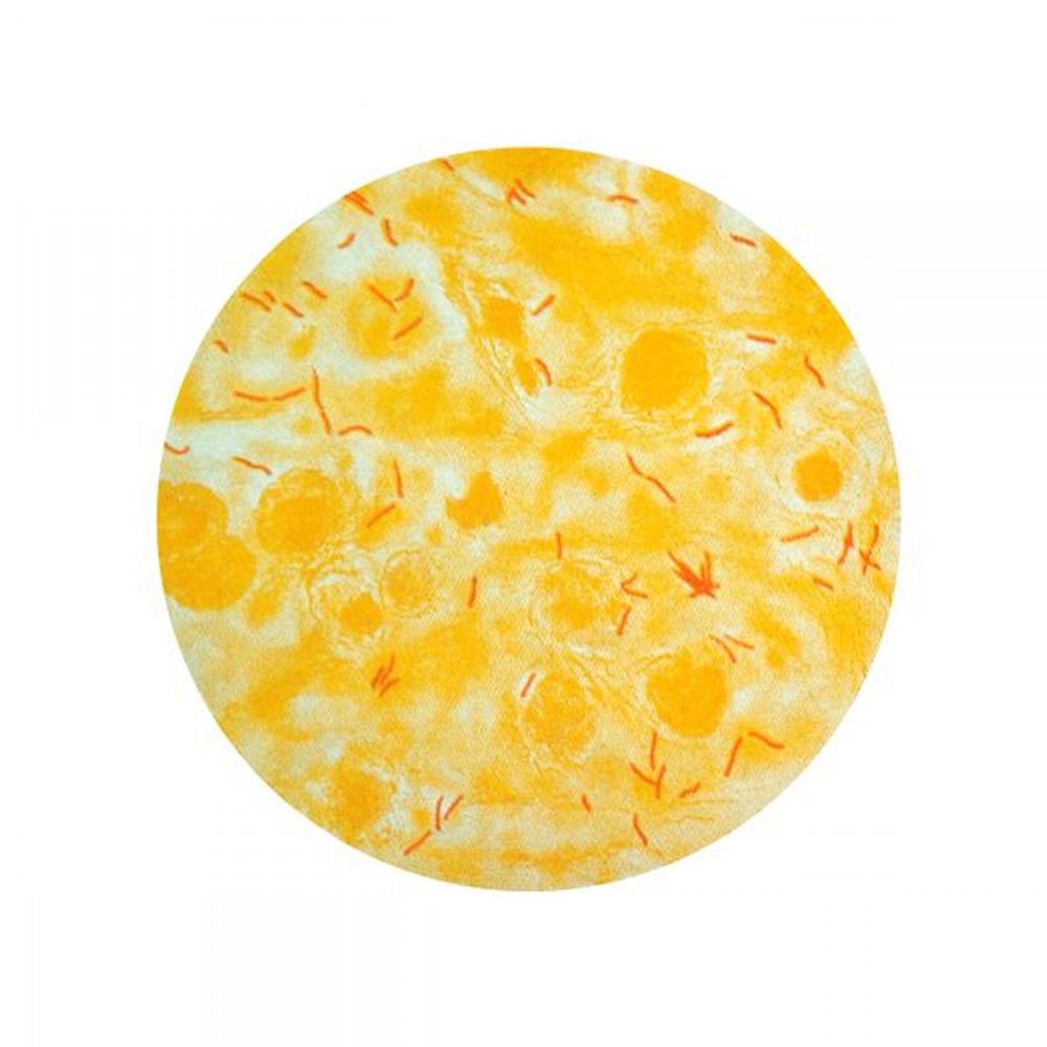 Coloration acido-résistante (<i >Mycobacterium tuberculosis</i>)