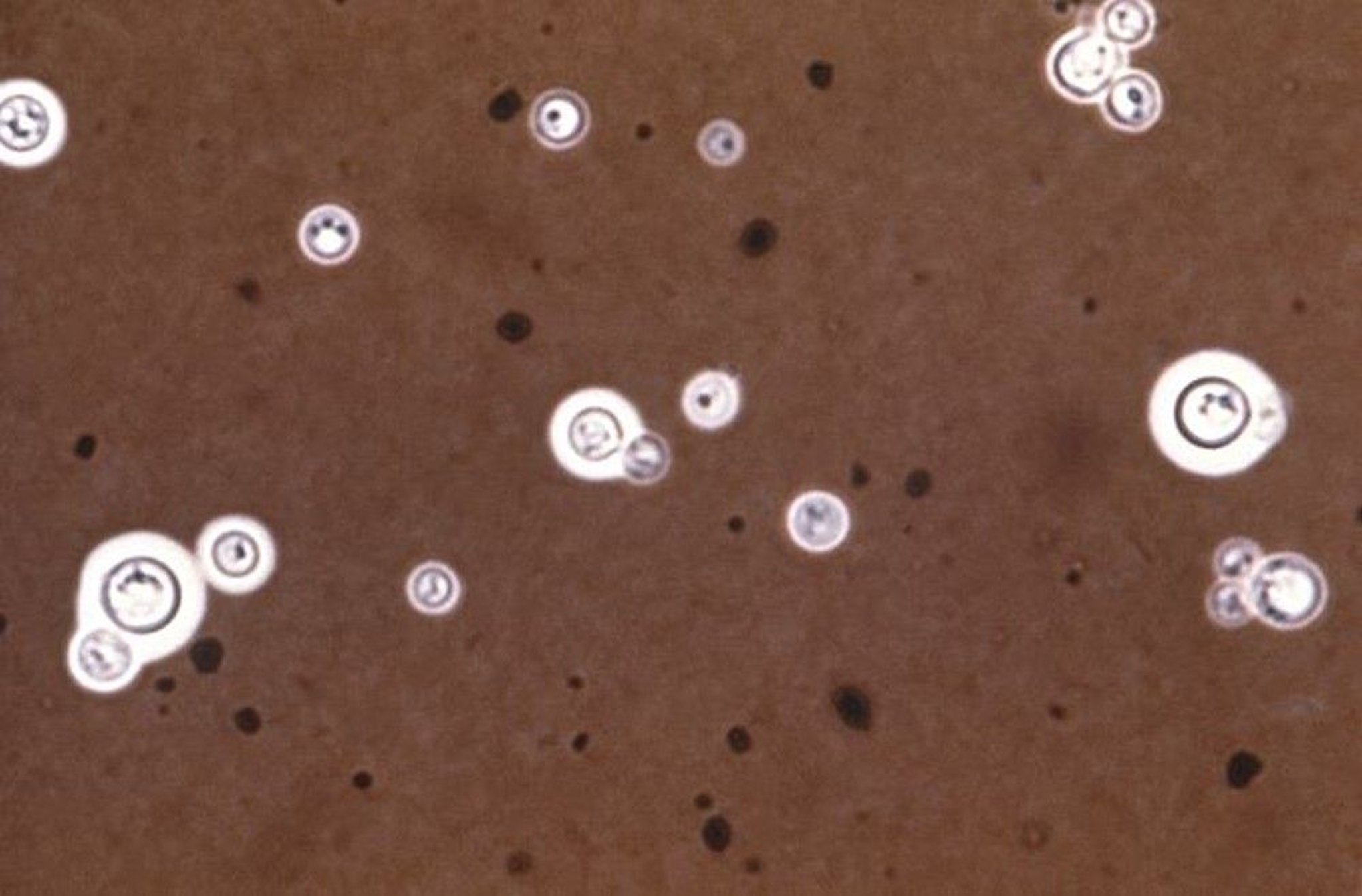 India Ink Stain (<i >Cryptococcus neoformans</i>)